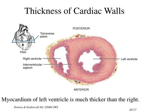 thickness of left ventricle wall